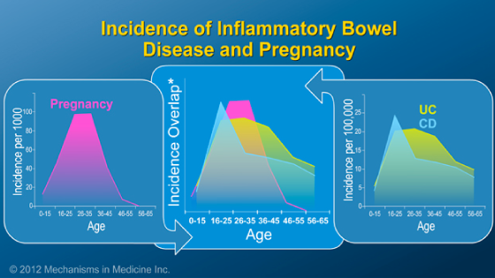 Pregnancy and IBD