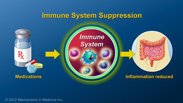 Immune System Suppression and IBD